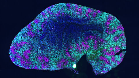 Cerebral organoid (mini-brain): two millimeter small specimen under the fluorescence microscope